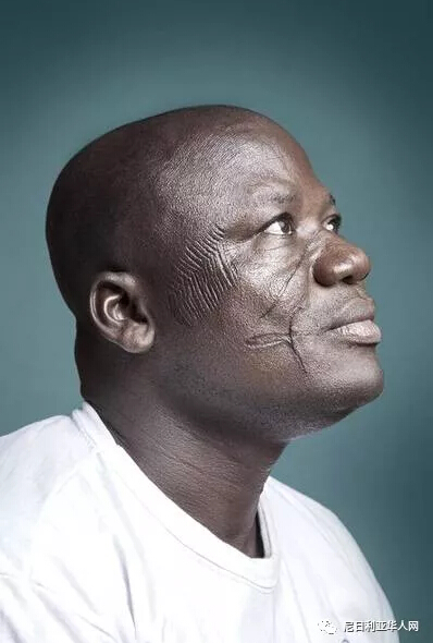 　　    　　科特迪瓦摄影师Joana Choumali拍摄了一组西非传统习俗Scarification，这是一种在皮肤上划上花纹的传统习俗，本是地位的象征，如今这种习俗已经逐渐消失了，现在只有在老一辈的脸上还能看到。  　　    　　图为Guemi先生：我已经把我的身份证刻在了脸上，人们很容易认识我，但是现在,这一切结束了，人们首先喊我刀疤男。  　　    　　图为Lawal先生：在小镇我是无名小卒，但是在村子里,我是一个高尚的，当他们看到我的脸，人们跪拜在我面前，我很自豪。  　　    　　图为K. Benin女士：我划刀疤的时候，我想成为像我的兄弟姐妹一样的人，以及表明我是勇敢的。  　　    　　图为Konabé先生：我们的父母在我脸上划出刀痕为了让我不迷失，当你去某个地方你就不会迷路。  　　    　　图为Boudo先生：不容讨得女孩的欢心，特别是现在年轻女孩的心，我认为它并没有吸引力。  　　    　　图为Pousnouaga先生：我还是为我的脸感到骄傲，我的妻子也为我骄傲。  　　    　　图为Djeneba女士：我曾经喜欢我的伤疤，觉得很漂亮，但现在在这个城市，这绝对是不合适了。  　　    　　图为Salbre先生：我不希望我的孩子们划刀疤，我们是最后一代划刀疤的人。  　　    　　图为Martine女士：我曾经觉得我还不够漂亮，因为刀疤还不够长，但是现在我觉得足够了，再多就真不好看了。  　　文章来自：尼日利亚华人网